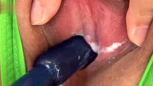 Hairless Teen's Rope Activity