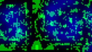 Gynekologická prohlídka