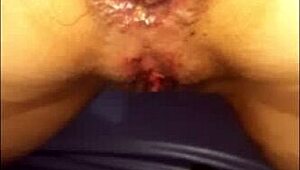 Un Pepinazo En Su Delicioso Culito Con Fisting Assfucking Anal