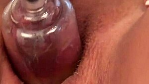 Lets play with sucking cups