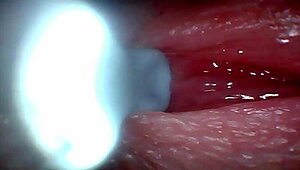 Ever wonder what endoscope sees during sloppy cumshot? Huge cocks drip creampie from public double anal with toys