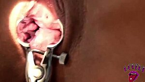 what if the doctor fisted that patient's ass in the strangest hospital anal adventure?