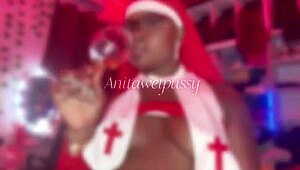 whoa trying these hot new nurse costumes my sugar daddy gifted does this patient need my ebony ass outside?!