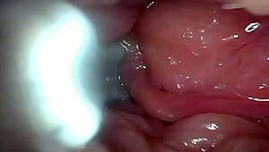 imagine semen flooding deep into that wide-stretched cervix via endoscope view