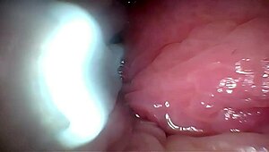 imagine semen flooding deep into that wide-stretched cervix via endoscope view