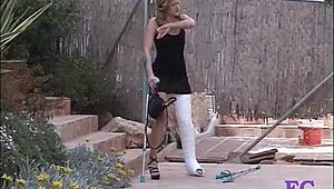 Fetisch Concept On Stairs And Outdoor With Cast Leg