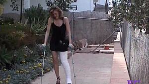 Fetisch Concept On Stairs And Outdoor With Cast Leg